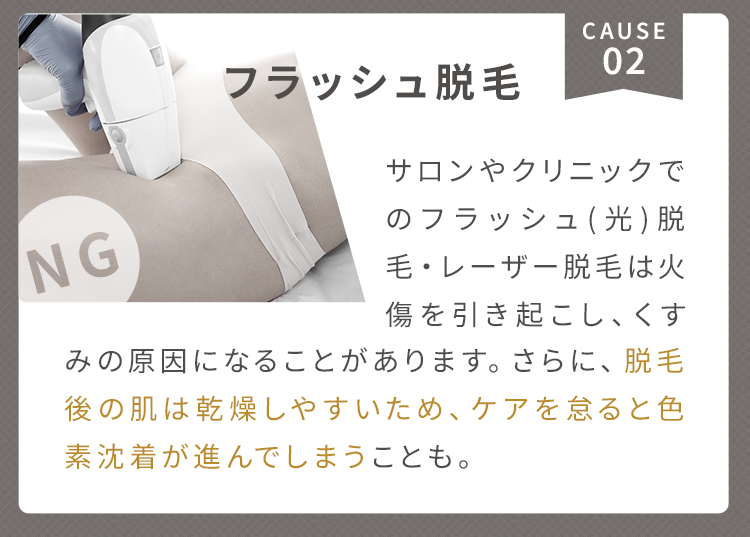 2.フラッシュ(光)脱毛